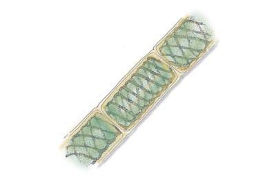 Drawing of Spirogyra cell