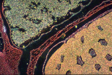 MALE SPORES OF A QUILLWORT
